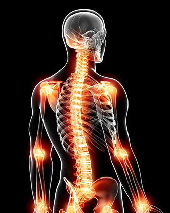 질환안내 이미지