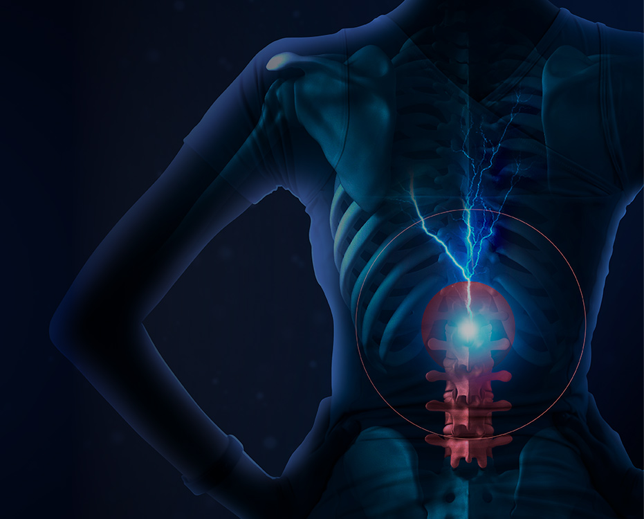 척추 내시경 이미지