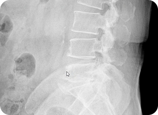 X-ray 검사 장비1