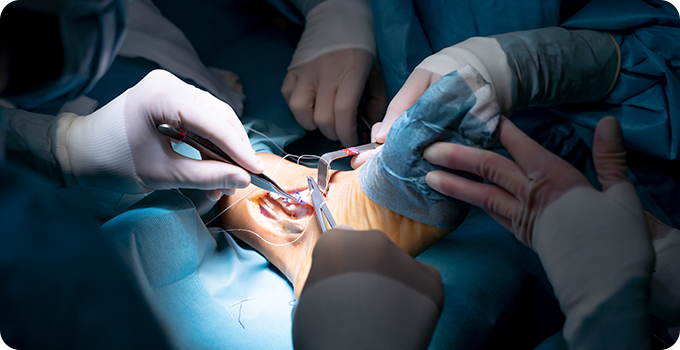 아킬레스건 봉합술&재건술