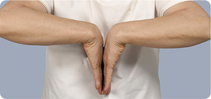 팔렌(Phalen) 테스트 사진