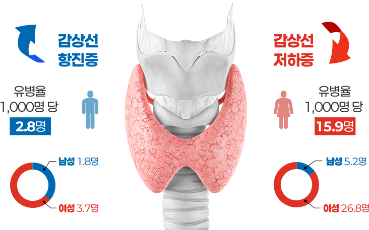 갑상선 질환 통계 도표