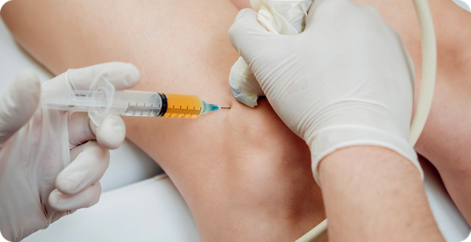 재생주사치료 치료 사진