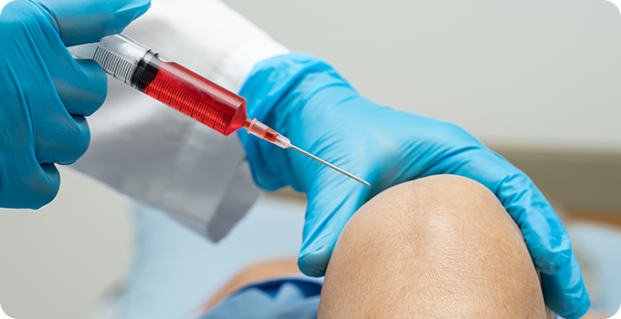 자가 줄기세포 주사치료 사진