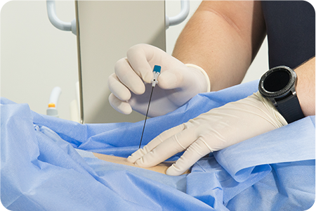 조영제 주입 및 확인하는 사진