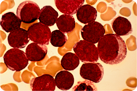 세포 처리 및 농축하는 사진