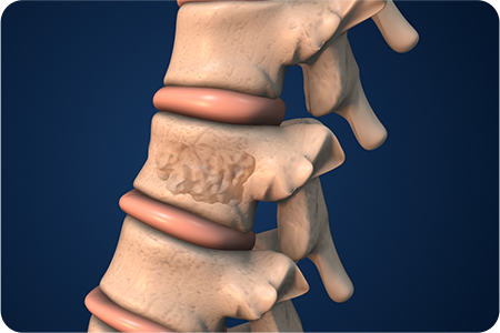 내부석고 형성 및 마무리 하는 사진