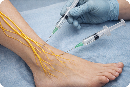 진단 및 시술 부위 확인하는 사진