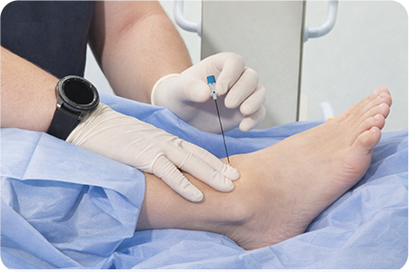 조영제 주입 및 확인하는 사진