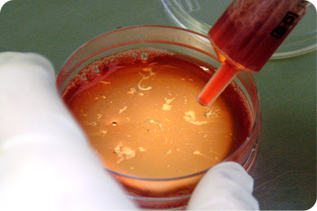 줄기세포 채취 및 분리하는 사진