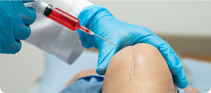 자가줄기세포주사치료 관련 이미지