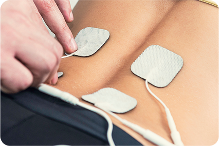 경피적 신경 전기자극 치료 사진