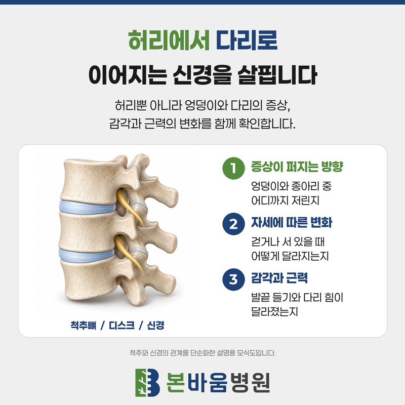 허리에서 다리로 이어지는 신경과 증상·감각·근력 확인 항목