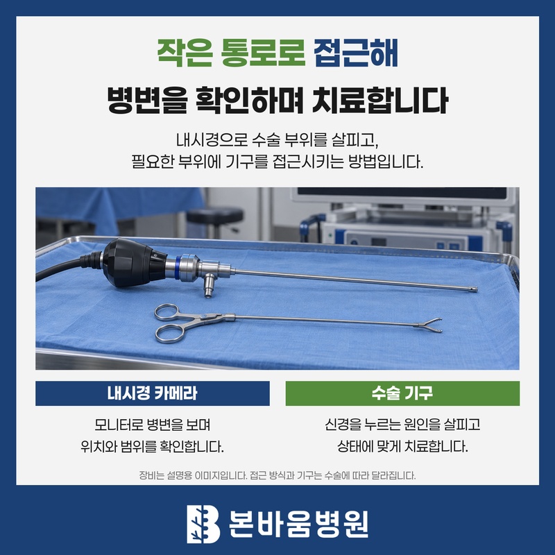 척추내시경 카메라와 수술 기구의 역할