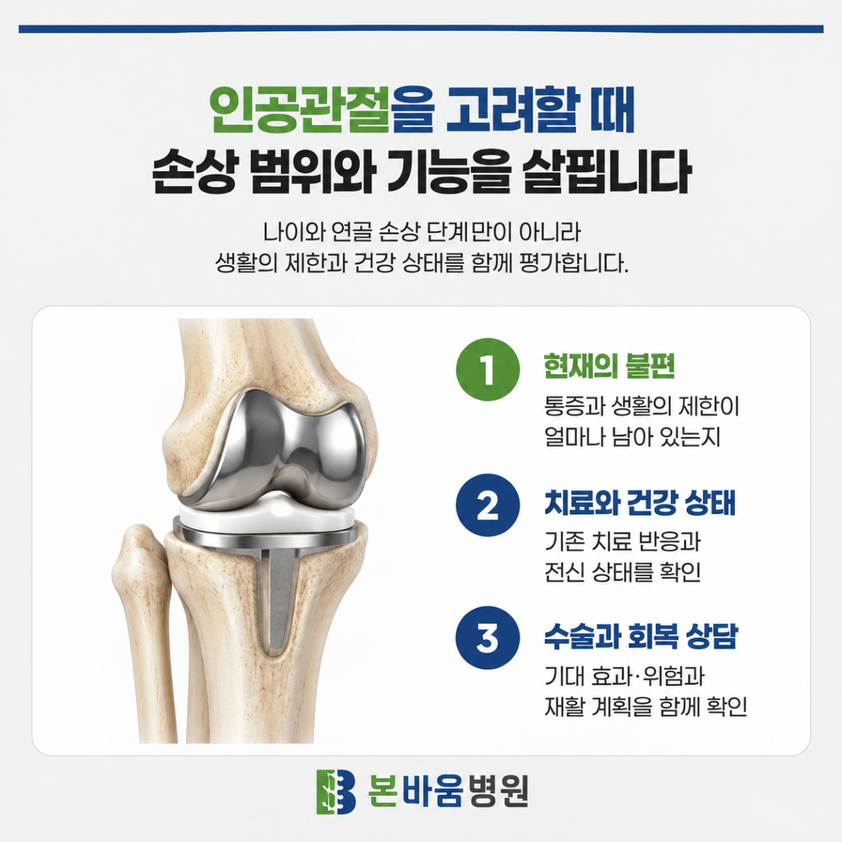 무릎 인공관절 구조와 수술 전 평가·회복 상담 사항