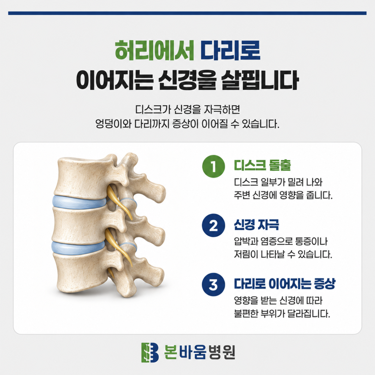 허리에서 다리로 이어지는 신경과 디스크 돌출·신경 자극 설명