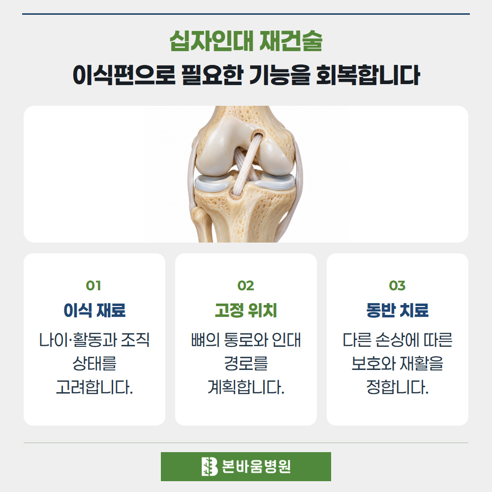 불광역정형외과 십자인대 재건 이식편 모델 — 십자인대 재건술 · 이식편으로 필요한 기능을 회복합니다
