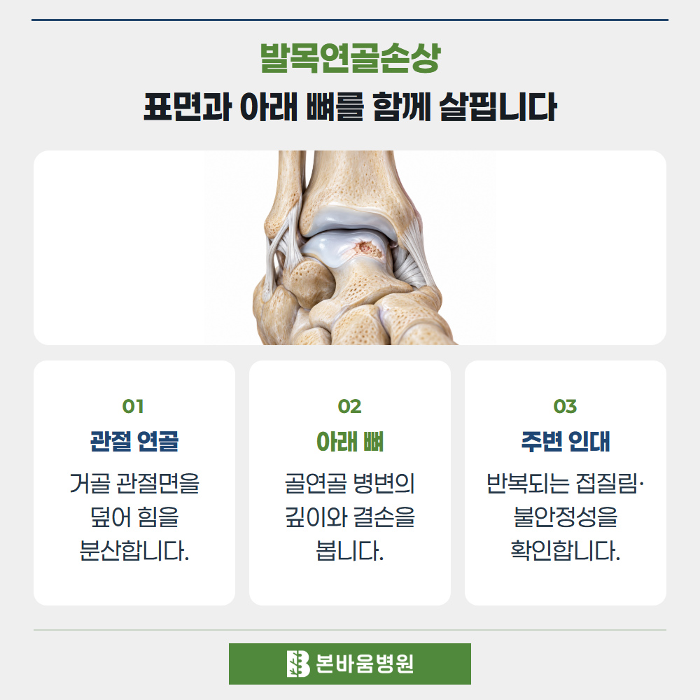 녹번역정형외과 거골돔의 연골·뼈 손상 — 발목연골손상 · 표면과 아래 뼈를 함께 살핍니다