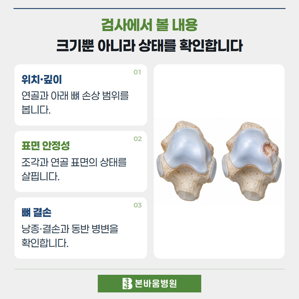 녹번역정형외과 거골 관절면 병변 비교 — 검사에서 볼 내용 · 크기뿐 아니라 상태를 확인합니다