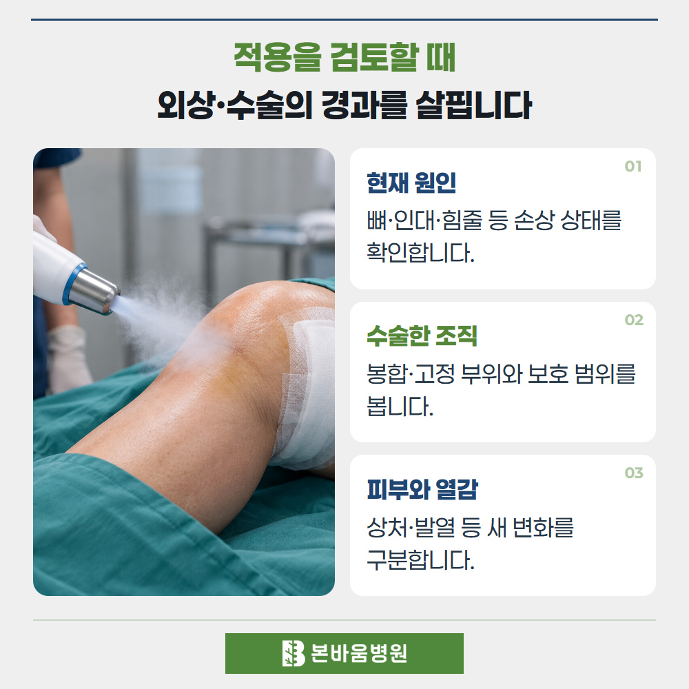 은평구정형외과 무릎 냉각분사 적용 — 적용을 검토할 때 · 외상·수술의 경과를 살핍니다