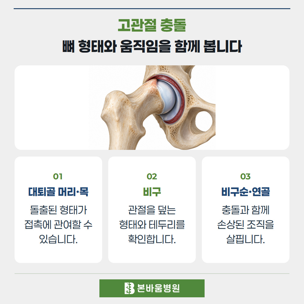 은평구정형외과 고관절 뼈와 관절순 그림 — 고관절 충돌 · 뼈 형태와 움직임을 함께 봅니다