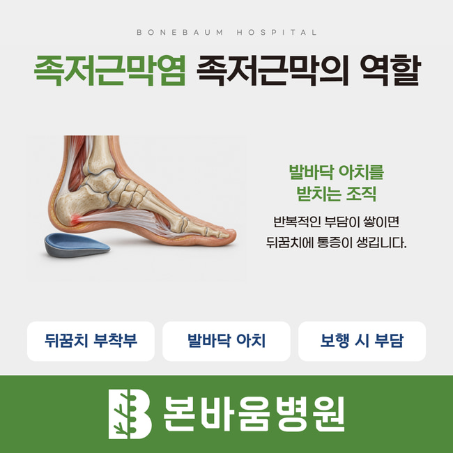 족저근막과 뒤꿈치 삽화로 발바닥 아치를 지지하는 역할과 통증을 설명한 카드