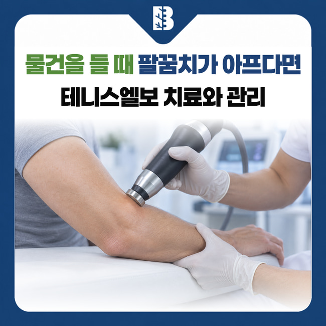 물건을 들 때 팔꿈치가 아프다면 테니스엘보 치료와 관리: 팔꿈치 바깥쪽에 체외충격파 기구를 접촉해 치료하는 설명용 이미지