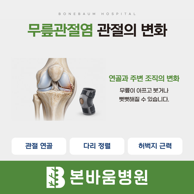무릎관절염의 연골 변화를 보여주는 삽화와 관절 연골·다리 정렬·허벅지 근력 설명