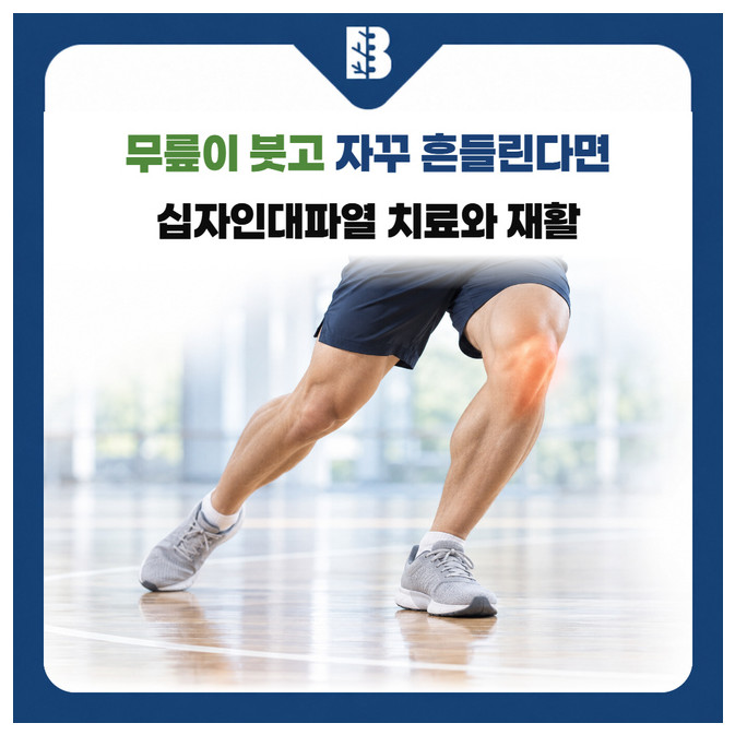 불광역정형외과 운동 중 발을 딛고 방향을 바꾸는 무릎의 움직임