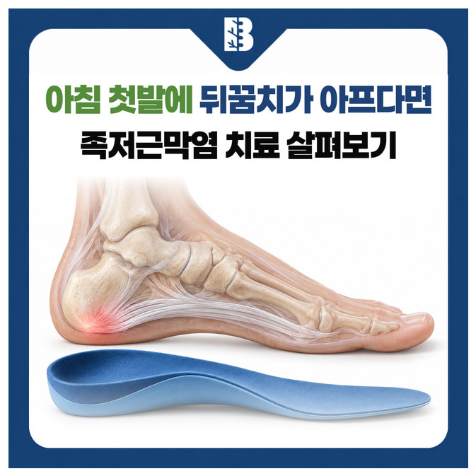 아침 첫발에 뒤꿈치가 아프다면 족저근막염 치료 살펴보기: 발바닥의 족저근막과 뒤꿈치 부위, 아치를 받치는 깔창을 함께 보여주는 설명용 삽화