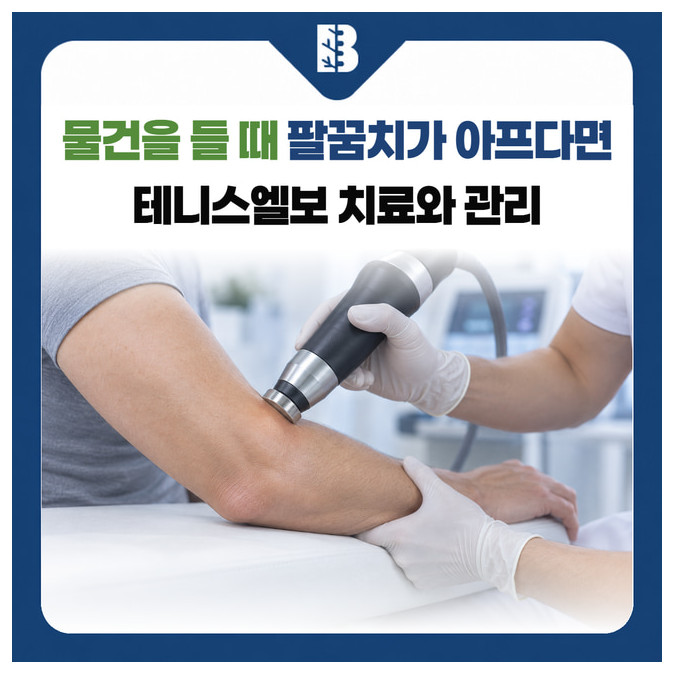 물건을 들 때 팔꿈치가 아프다면 테니스엘보 치료와 관리: 팔꿈치 바깥쪽에 체외충격파 기구를 접촉해 치료하는 설명용 이미지